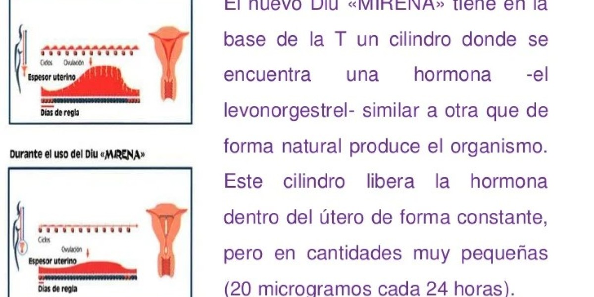 Descubre la verdad sobre si el anticonceptivo Mirena realmente causa aumento de peso